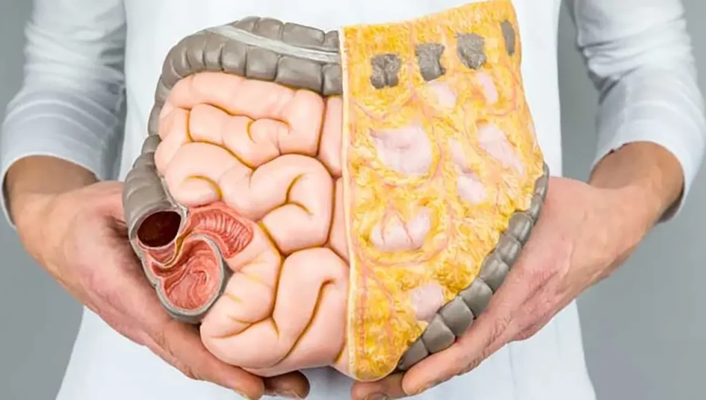 Grasa visceral